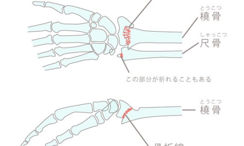 淋病跟普通尿路感染区别网 :分享淋病跟梅毒的区别-淋病和尿道炎是一种病吗知识